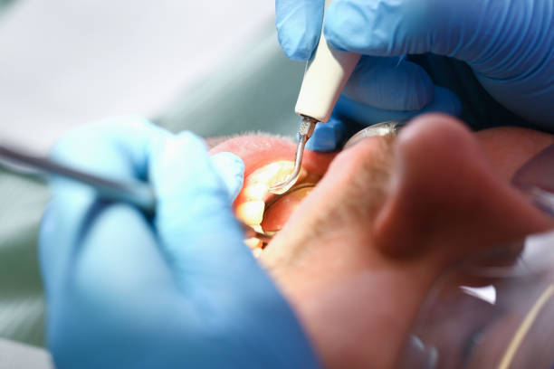 Best Dentist for Tooth Abscess  in Van Horn, TX