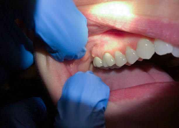 Best Emergency Gum Pain Relief  in Van Horn, TX