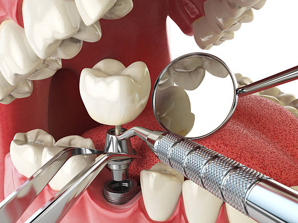 Trusted TX Emergency Dentist Experts